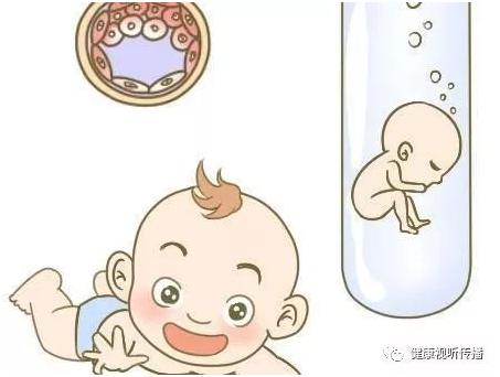 关于极光